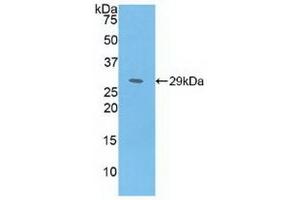 Detection of Recombinant MAT2a, Human using Polyclonal Antibody to Methionine Adenosyltransferase II Alpha (MAT2a) (MAT2A antibody  (AA 176-395))