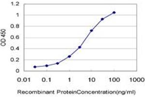 Detection limit for recombinant GST tagged DTX3L is approximately 0. (DTX3L antibody  (AA 3-110))