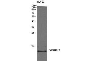 Western Blotting (WB) image for anti-S100 Calcium Binding Protein A7-Like 2 (S100A7L2) (Internal Region) antibody (ABIN3186865) (S100A7L2 antibody  (Internal Region))