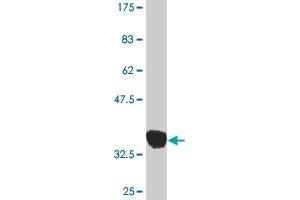 Western Blot detection against Immunogen (36. (MAP2K3 antibody  (AA 1-100))
