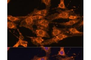 Immunofluorescence analysis of C6 cells using UBQLNL Polyclonal Antibody at dilution of 1:100. (UBQLNL antibody)