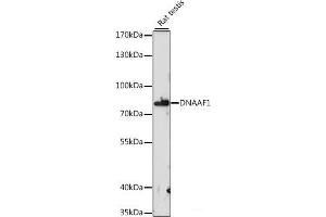 Western blot analysis of extracts of Rat testis using DNAAF1 Polyclonal Antibody at dilution of 1:1000. (LRRC50 antibody)