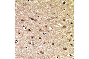 Immunohistochemical analysis of MIB1 staining in human brain formalin fixed paraffin embedded tissue section. (MIB1 antibody  (C-Term))