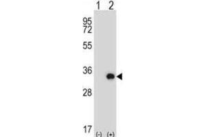 Western Blotting (WB) image for anti-Testis-Specific Serine Kinase 6 (TSSK6) antibody (ABIN2997885) (TSSK6 antibody)