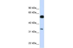 C19ORF62 antibody used at 1 ug/ml to detect target protein. (BRISC and BRCA1 A Complex Member 1 (BABAM1) (N-Term) antibody)