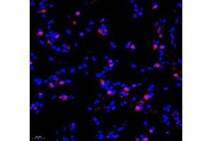 Immunofluorescence of paraffin embedded mouse lung using TEAD3 (ABIN7075852) at dilution of 1: 700 (400x lens) (TEAD3 antibody)