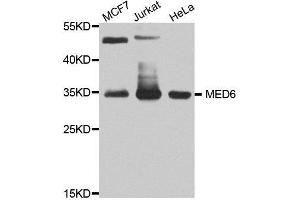 Western blot analysis of extracts of various cell lines, using MED6 antibody. (MED6 antibody  (AA 27-246))