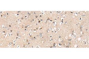 Immunohistochemistry of paraffin-embedded Human brain tissue using C14orf2 Polyclonal Antibody at dilution of 1:60(x200) (C14orf2 antibody)