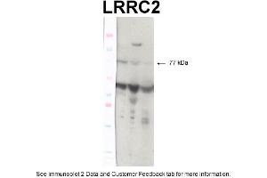 WB Suggested Anti-TP53 Antibody Titration: 0. (LRRC2 antibody  (N-Term))