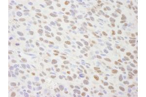 Immunohistochemistry (IHC) image for anti-Tripartite Motif Containing 24 (TRIM24) (AA 700-750) antibody (ABIN7448834) (TRIM24 antibody  (AA 700-750))