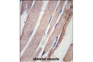 Formalin-fixed and paraffin-embedded human skeletal muscle tissue reacted with PHPT1 Antibody (C-term), which was peroxidase-conjugated to the secondary antibody, followed by DAB staining. (PHPT1 antibody  (N-Term))