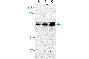 Western blot analysis of EIF2AK2 in A-431 whole cell lysate with EIF2AK2 polyclonal antibody  at (A) 0. (EIF2AK2 antibody  (C-Term))