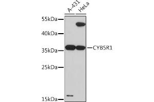 Western blot analysis of extracts of various cell lines, using CYB5R1 Rabbit pAb (ABIN7266630) at 1:3000 dilution. (CYB5R1 antibody  (AA 1-305))
