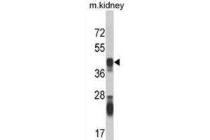 Western Blotting (WB) image for anti-Argininosuccinate Synthase 1 (ASS1) antibody (ABIN3002823)