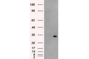 HEK293T cells were transfected with the pCMV6-ENTRY control (Left lane) or pCMV6-ENTRY AKR1A1 (Right lane) cDNA for 48 hrs and lysed. (AKR1A1 antibody)