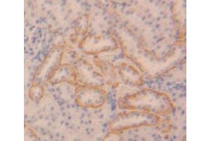 Figure. (IKbIP antibody  (AA 80-315))