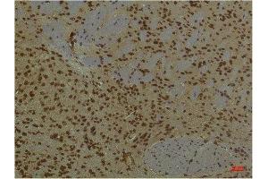 Immunohistochemistry (IHC) analysis of paraffin-embedded Mouse Brain Tissue using HIF-1 beta/ARNT Mouse Monoclonal Antibody diluted at 1:200.
