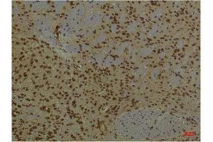 Immunohistochemistry (IHC) analysis of paraffin-embedded Mouse Brain Tissue using HIF-1 beta/ARNT Mouse Monoclonal Antibody diluted at 1:200. (ARNT antibody)