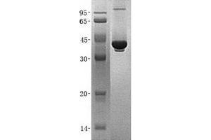Validation with Western Blot (GALM Protein (His tag))