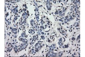 Immunohistochemistry (IHC) image for anti-Interferon Regulatory Factor 3 (IRF3) antibody (ABIN1498899) (IRF3 antibody)