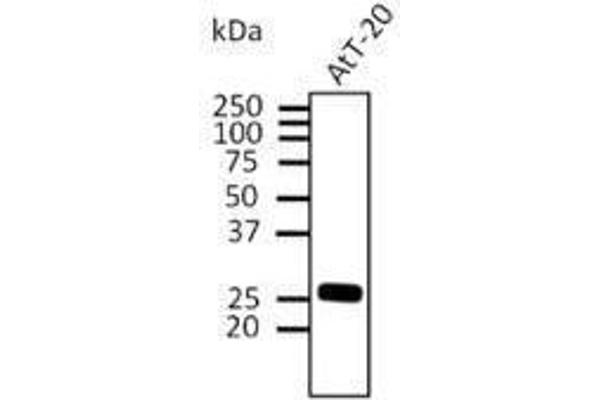 RAB3A Antikörper  (C-Term)
