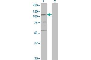 Western Blot analysis of SMC3 expression in transfected 293T cell line by CSPG6 monoclonal antibody (M02), clone 2F11. (SMC3 antibody  (AA 711-810))