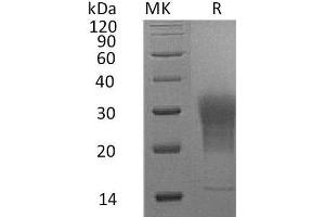 Leukocyte-Associated Immunoglobulin-Like Receptor 1 (LAIR1) (AA 22-141) protein (His tag)