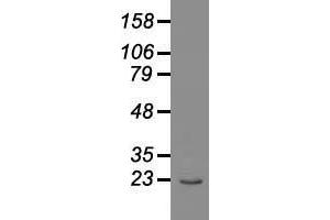 Western blot analysis of 35 µg of cell extracts from human Liver carcinoma (HepG2) cells using anti-AK1 antibody. (Adenylate Kinase 1 antibody)