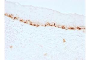 IHC testing of FFPE human skin stained with MART-1 antibody (clone M2-7C10). (MLANA antibody)