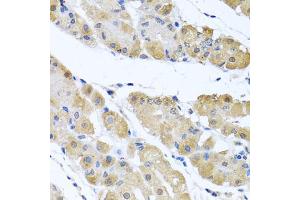 Immunohistochemistry of paraffin-embedded human stomach using OGFR antibody (ABIN5974255) at dilution of 1/100 (40x lens). (OGFR antibody)