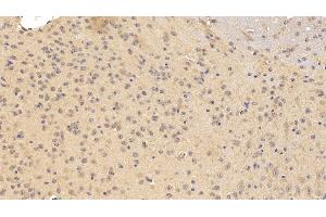 Detection of TNFRSF21 in Mouse Cerebrum Tissue using Polyclonal Antibody to Tumor Necrosis Factor Receptor Superfamily, Member 21 (TNFRSF21) (TNFRSF21 antibody  (AA 406-605))