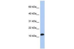 Image no. 1 for anti-Ribosomal Protein L30 (RPL30) (C-Term) antibody (ABIN6743984) (RPL30 antibody  (C-Term))