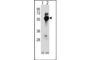Western blot analysis of DARS (arrow) using DARS1 Antibody (N-term) Cat. (DARS antibody  (N-Term))