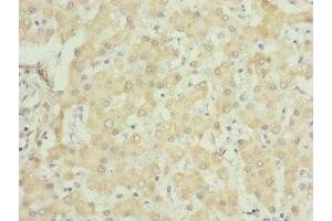 Immunohistochemistry of paraffin-embedded human liver tissue using ABIN7149102 at dilution of 1:100 (UQCRC1 antibody  (AA 156-480))