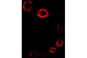 Immunofluorescent analysis of HMGCR staining in A549 cells. (HMGCR antibody)