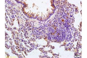 Formalin-fixed and paraffin embedded rat lung tissue labeled with Anti-IL-22R Polyclonal Antibody, Unconjugated (ABIN748178) at 1:200 followed by conjugation to the secondary antibody and DAB staining (IL22 Receptor alpha 1 antibody  (AA 41-150))