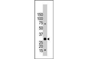 The YWHAB polyclonal antibody  is used in Western blot to detect YWHAB in Jurkat cell lysate.