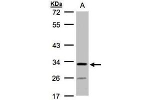 WB Image Sample(30 ug whole cell lysate) A:H1299 10% SDS PAGE antibody diluted at 1:1000 (C4orf19 antibody)