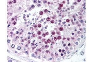 Anti-SIRT1 antibody IHC of human testis. (SIRT1 antibody  (C-Term))