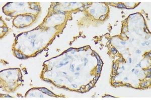 Immunohistochemistry of paraffin-embedded Human placenta using ALPP Polyclonal Antibody at dilution of 1:100 (40x lens). (PLAP antibody)