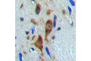 Immunohistochemical analysis of Histone Deacetylase 6 (pS22) staining in human brain formalin fixed paraffin embedded tissue section. (HDAC6 antibody  (N-Term, pSer22))