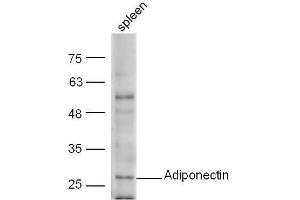 Mouse spleen lysate probed  at 1:5000 90min in 37˚C.