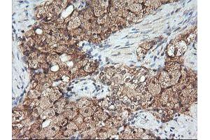 Image no. 5 for anti-Mitogen-Activated Protein Kinase Kinase 1 (MAP2K1) antibody (ABIN1499388) (MEK1 antibody)