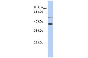WB Suggested Anti-SS18L1 Antibody Titration: 0.