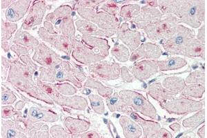 Human Heart (formalin-fixed, paraffin-embedded) stained with PNPLA2 antibody ABIN337131 at 2. (PNPLA2 antibody  (AA 68-79))
