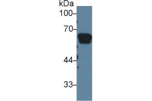 Western blot analysis of Rat Serum, using Rat AGT Antibody (1 µg/ml) and HRP-conjugated Goat Anti-Rabbit antibody (