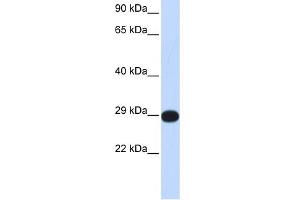 WB Suggested Anti-PPP4C Antibody Titration: 0. (PPP4C antibody  (Middle Region))