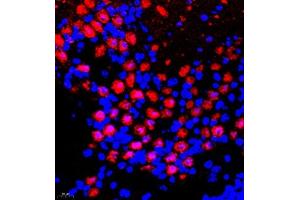 Immunofluorescence of paraffin embedded mouse epencephalon using Bora (ABIN7075236) at dilution of 1:200 (400x lens) (BORA antibody)
