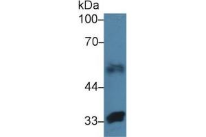 Rabbit Capture antibody from the kit in WB with Positive Control: Sample Human lung lysate.