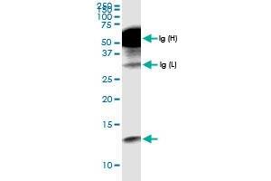 Immunoprecipitation of CCL18 transfected lysate using anti-CCL18 MaxPab rabbit polyclonal antibody and Protein A Magnetic Bead , and immunoblotted with CCL18 MaxPab rabbit polyclonal antibody (D01) . (CCL18 antibody  (AA 1-89))